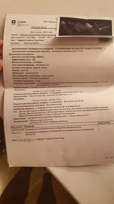 Полип эндометрия. Удалять или нет? | Лейб-Медик про беременность, здоровое  материнство и жизнь без климакса. | Дзен