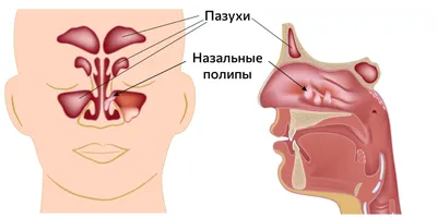 Вопрос медикам. Что это такое? | Пикабу