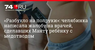 Диаскинтест, проба Манту: допустимо ли ими пренебрегать? - Континент Сибирь  Online Общество