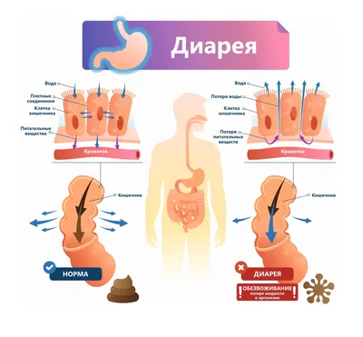 Понос - ЯПлакалъ