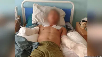 Ударило током в 10 000 вольт мальчика в Дагестане - что случилось, выжил  или нет, последствия - KP.RU