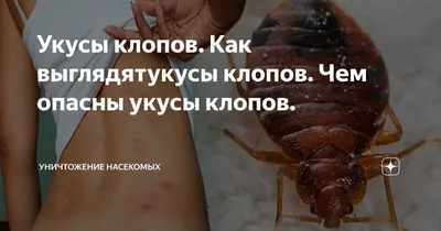 Клопы и их укусы: опасность и способы борьбы | Мир без вредителей | Дзен