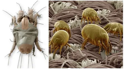 Чем опасны пылевые клещи и как от них избавиться - Лайфхакер