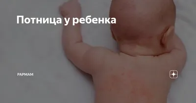 Отличница - Потница у детей Узнаем как избежать потнички новорожденных.  https://mamahealth.ru/deti/302-potnichka-u-novorozhdennyx.html | Facebook