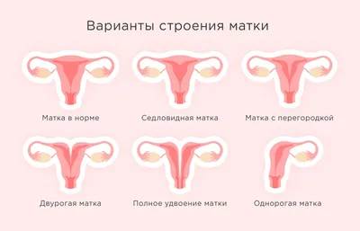 Лучшие позы для зачатия ребенка: как заниматься сексом чтобы забеременеть |  ФОРМА