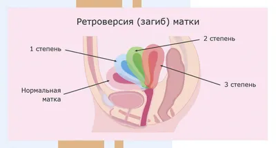 Полный список эффективных поз для зачатия ребенка: лучшие позиции для  зачатия