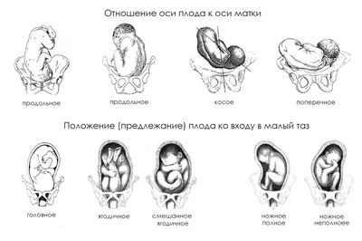 👶Что сделать, чтобы ребёнок перед родами принял правильное положение |  Нина Красоткина Свои на Бали | Дзен