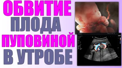 Зачем нужен кокон⁉️ Часто меня спрашивают... ⠀ ✔️Ребенок в утробе матери  находится в «позе эмбриона». ⠀ 👉После рождения, происходит пос… | Ребенок,  Дети, Адаптация