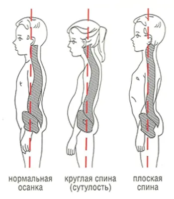 Какими показателями характеризуется правильная осанка человека