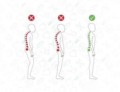 Правильная осанка: почему это важно и что для этого нужно | РБК Стиль