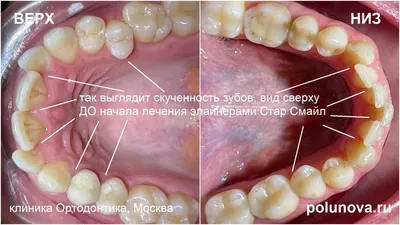 Правильный прикус у человека: фото зубов | Dental Art