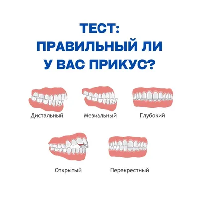 Правильный прикус и ровные зубы | «Доктор Зубов»