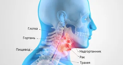 Причины и факторы риска онкологии рта - злокачественные опухоли полости рта  | НоваДент