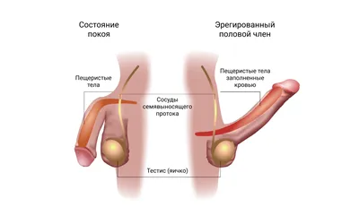 Приапизм у мужчин: почему долгая эрекция не всегда плюс? - СилаМЭН