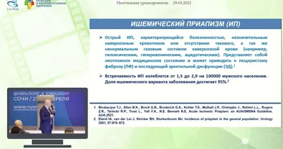 Приапизм: симптомы, причины, диагностика, лечение| АО «Медицина» (клиника  академика Ройтберга)