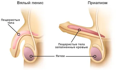 Приапизм. Определение - презентация онлайн