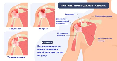 Мешки под глазами: как убрать в домашних условиях отеки, малярные суфы,  грыжи | Beauty Insider