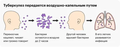 Пентаксим – французская вакцина против дифтерии, столбняка, гемофильной  инфекции, полиомиелита и коклюша