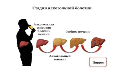 Скрытая угроза: медики рассказали о симптоме повышенного холестерина |  Статьи | Известия