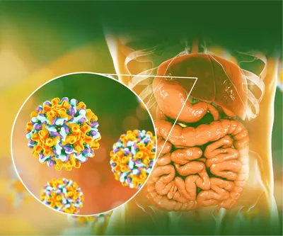 Болезнь Боткина (гепатит А): симптомы, диагностика, лечение | Клиника  Эксперт