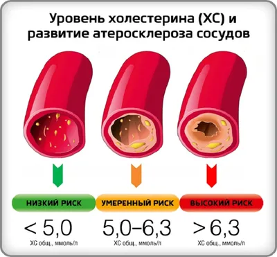 Врач назвала признак высокого холестерина, появляющийся на лице -  Российская газета