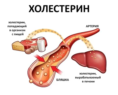 6 признаков повышенного холестерина, которые легко распознать по изменениям  на коже | DOCTORPITER