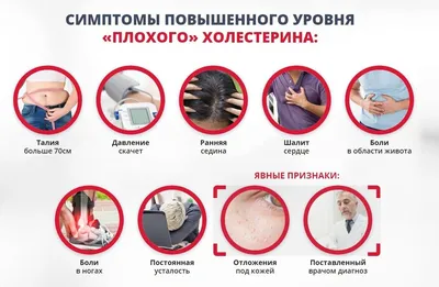 Изменения в глазах могут указывать на повышенный уровень холестерина |  DOCTORPITER