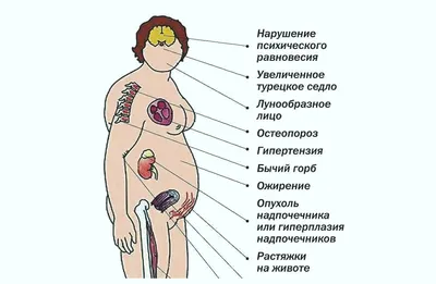 Гиперпролактинемия – повышение уровня пролактина: норма у женщин в крови,  причины, жалобы, диагностика и методы лечения