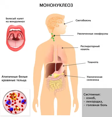 Желтуха, гепатит и цирроз печени - симптомы, диагностика и лечение