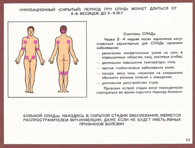 Санитарное просвещение в борьбе с ВИЧ-инфекцией