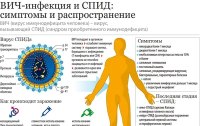 Симптомы ВИЧ у мужчин и женщин и лечение болезни: коротко о коварном  заболевании — Секрет фирмы