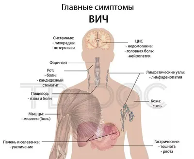 ВИЧ и СПИД - Республиканский Центр \"СПИД\" МЗ КР