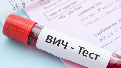 Какие у вас были симптомы после инфицирования ВИЧ? | форум hiv.plus