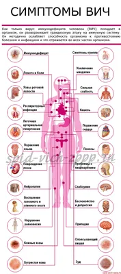 Какие самые первые признаки ВИЧ? | Записки врача из очага | Дзен