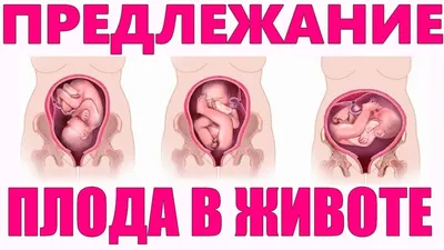 Поперечное положение плода в 29, 28, 30, 32 недели: причины, упражнения для  переворота