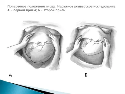 Как определить положение ребенка в животе самостоятельно - YouTube