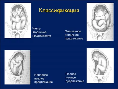 Низкая плацента при беременности: чем опасна и как рожать - статья  репродуктивного центра «За Рождение»