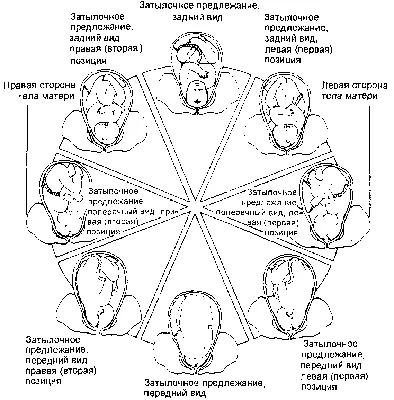 Перинатальный центр ККБ2 - Доброго дня дорогие 🤗 . 🧐Неправильное положение  плода❓ Положение плода может быть продольное, поперечное и косое .  🤰🏼Правильное положение плода — это продольное, а правильное предлежание -  это