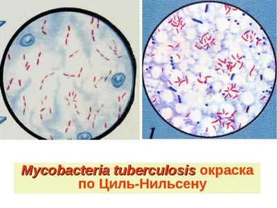 https://dzen.ru/a/YmvYmx9nCCGmYz8O