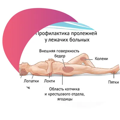 Лечение пролежней на дому. Уход за пролежнями