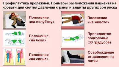 🔻ПРОЛЕЖНИ🔻 это патологическое состояние мягких тканей, которое связано с  некрозом. ▪️Обуславливается оно тем, что на ткани постоянно… | Instagram