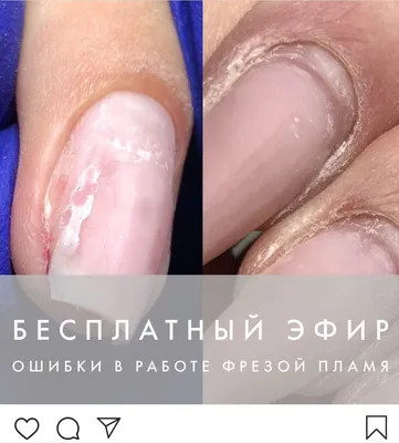 Салон Красоты «КОРОНА» on Instagram: \"Пропилы ногтевой пластины после  аппаратного маникюра. 💅Пропилы это следы, оставленные фрезой на  поверхности ногтевой пластины. Повреждения бывают поверхностные или  глубокие, но они всегда требуют восстановления ...