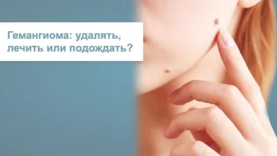 Удаление гемангиомы и винных пятен в Киеве. Цена - Coolaser Clinic