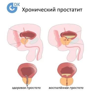 Отзывы о товаре: Витаминно-минеральный комплекс PharmaMed Man's formula  Простата Форте, 60 капсул