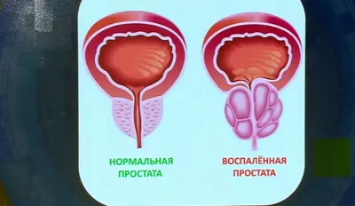 ➤ Компьютерная Томография простаты в Киеве - Лайфскан