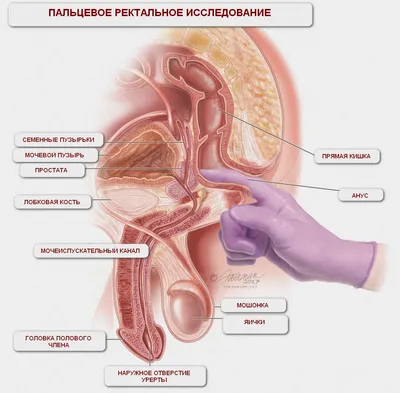 Аденома предстательной железы | Симптомы, осложнения, диагностика и лечение  | ВЦЭРМ им. А.М. Никифорова МЧС России в Санкт-Петербурге