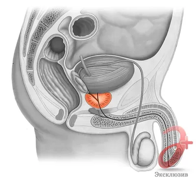 Аденома предстательной железы | Симптомы, осложнения, диагностика и лечение  | ВЦЭРМ им. А.М. Никифорова МЧС России в Санкт-Петербурге