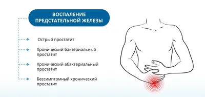 Массаж предстательной железы — Википедия