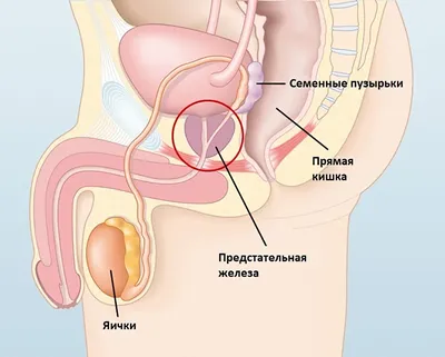 Простатит