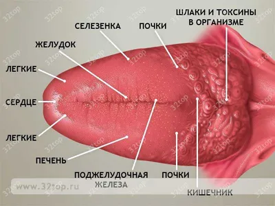 Прыщ на языке: виды, цвет прыща, на корне языка, на кончике языка, под  языком